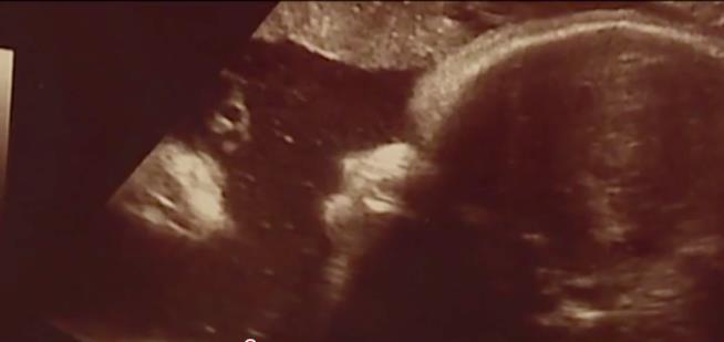 Parents Say They Spotted Jesus in Daughter's Sonogram
