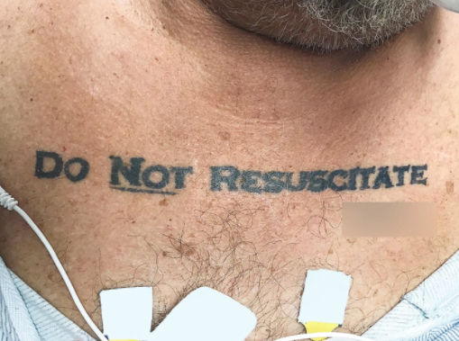 Doctors Vexed by Patient's Highly Unusual Tattoo