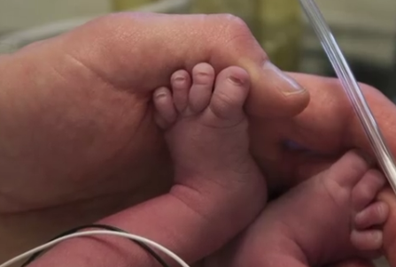 Woman Born Without Uterus Gives Birth for 1st Time in US