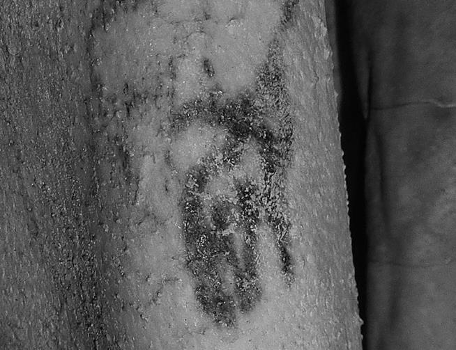 This Might Be the Oldest Tattoo Ever Discovered
