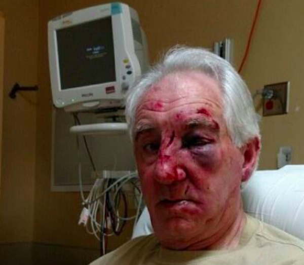 Cops Seek Guy in Road-Rage Beating of Elderly Man