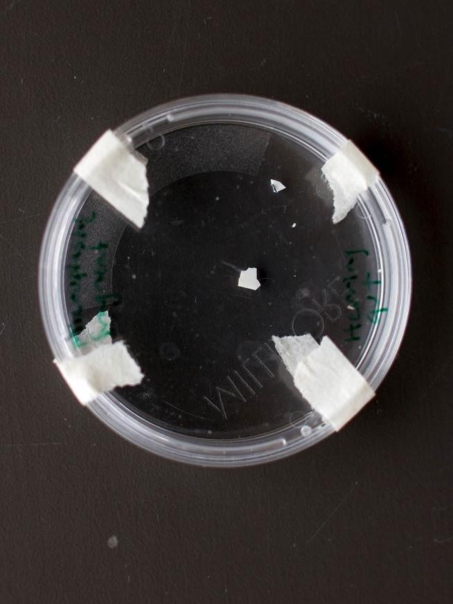 'First Evidence for Microplastics Inside Humans' Emerges