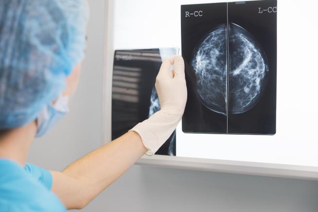 Mothers May Face Increased Risk of Breast Cancer