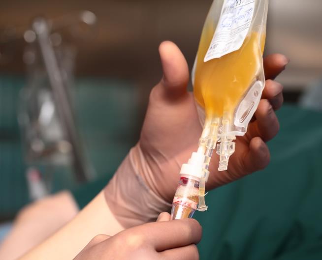 FDA: Beware of Young Blood Transfusions