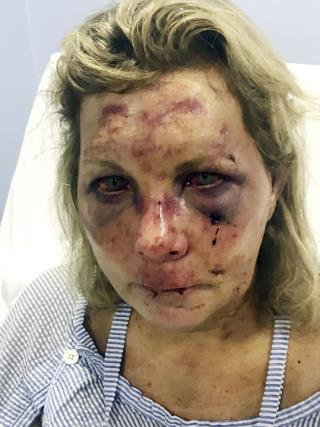 Resort Casts Doubt on Woman's Claim of Attack