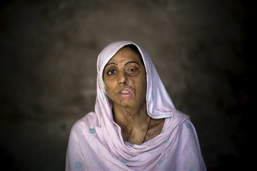Pakistani Salon Hires Fire, Acid Attack Victims