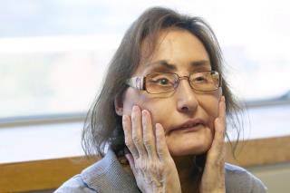 Connie Culp, Face Transplant Pioneer, Dies