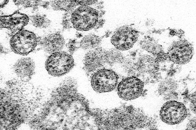 Woman Dies After Catching Virus Twice