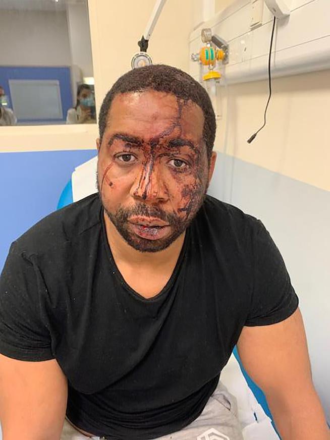 French Cops Suspended for Beating Black Man