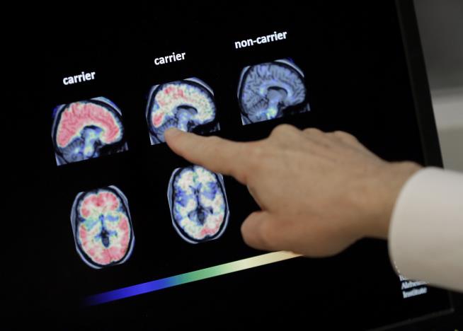 FDA Approves Controversial New Alzheimer's Drug