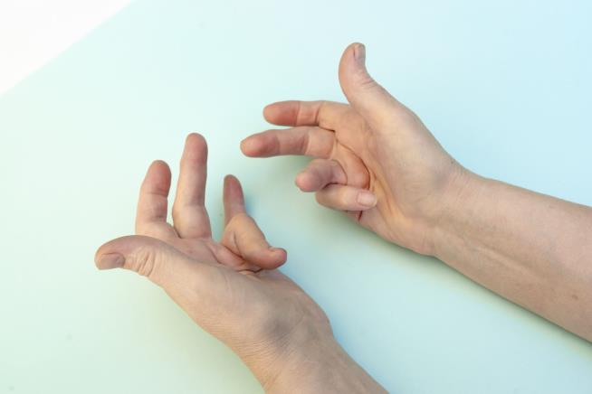 Possible 'Game-Changer' for Incurable Hand Disease