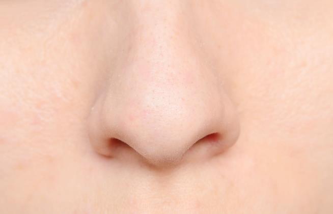Wife's Sharp Nose Leads to New Test for Parkinson's