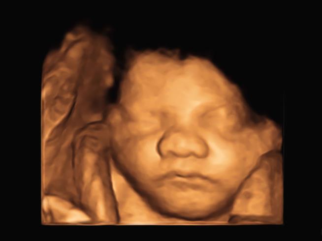 Fetuses' Faces Offer Clues on What Foods They Like