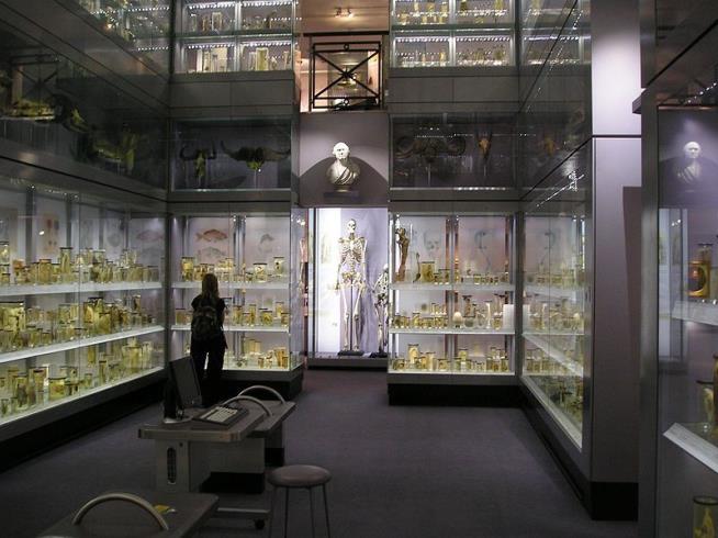 Museum Is Removing Skeleton of 'Irish Giant'