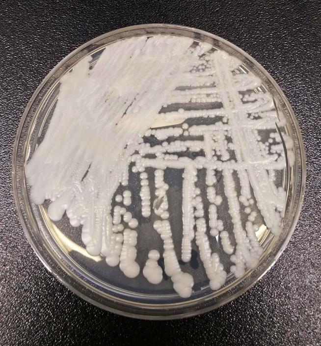 CDC: 'Killer Fungus' Spreading at 'Alarming Rate'