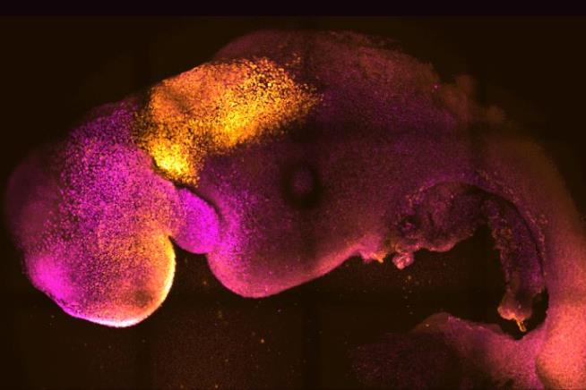 First Synthetic Human Embryo Raises Hope— and Concern