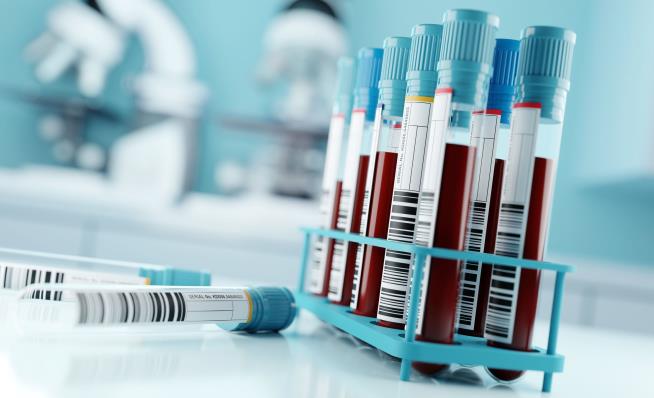 Blood Test Could Lead to Routine Alzheimer's Screening