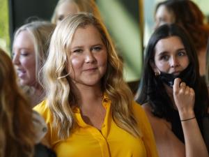 Amy Schumer: I Have Cushing Syndrome