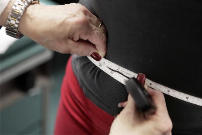 Severe Obesity Among Women Is on the Rise