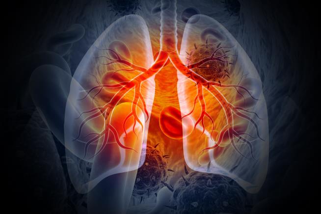 Lung Cancer Patients Benefit From 'Golden Age' of Research