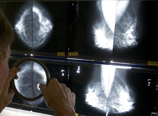 Studies Suggest Some Early Breast Cancer Surgeries Unnecessary