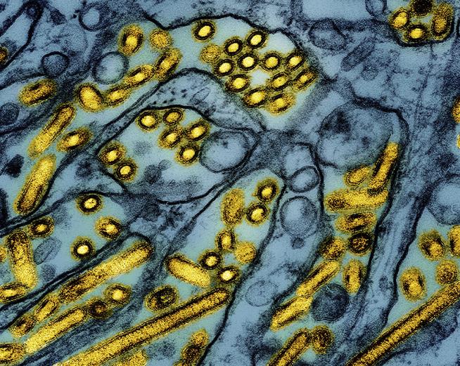 CDC: Louisiana Patient Has First Severe Bird Flu Case in US