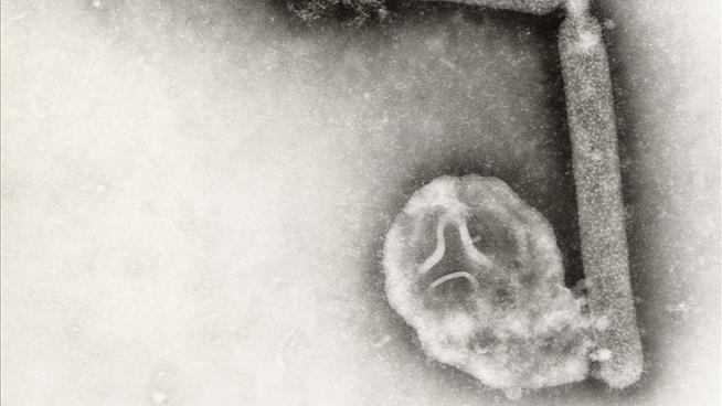 Human Bird Flu Cases Are Suddenly Harder to Find