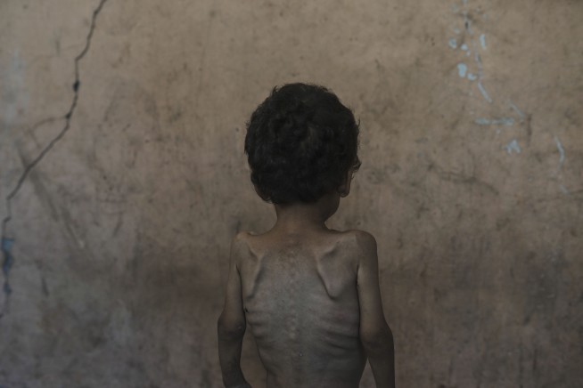 Experts: 'Worst-Case Scenario of Famine' Is Happening in Gaza