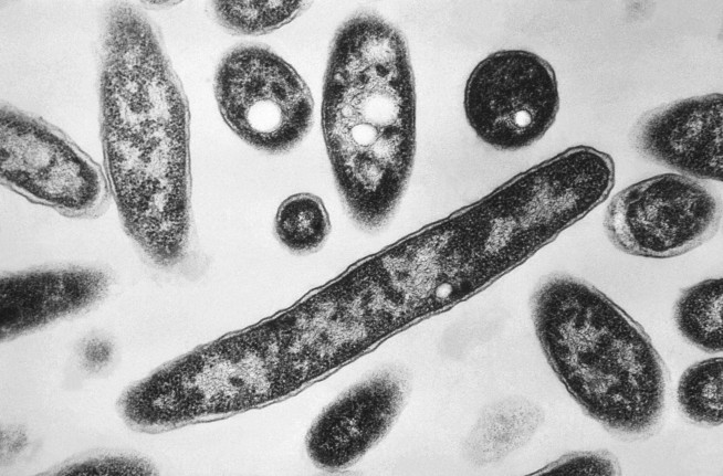 2 Dead Legionnaires' Outbreak in NYC