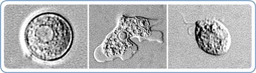 Waterskiing May Have Led to Rare Brain-Eating Infection