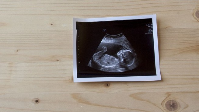 They Turned to Surrogacy, Only to See Their Money Vanish