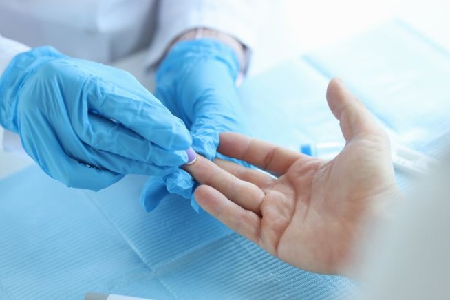 Finger-Prick Test May Reveal Alzheimer's