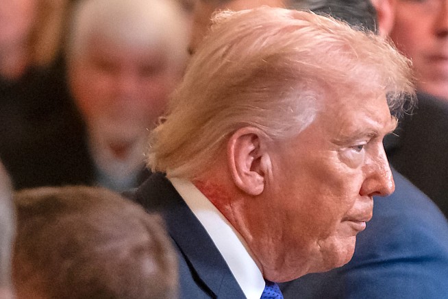 White House Explains Redness on Trump's Neck