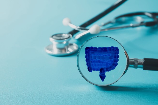 Colorectal Cancer Now Top Cancer Killer for Americans Under 50