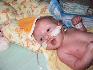 Sick Baby Stuns Doctors By Surviving Off Life Support