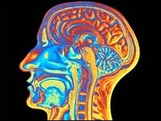 Scientists Locate Brain's Sentimental Center