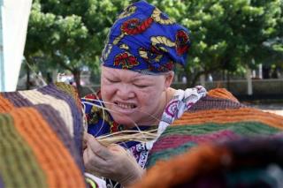 Tanzania Opens Trials in Killings of Albinos