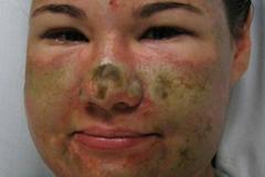 Woman Confesses To Acid Attack Being Fake