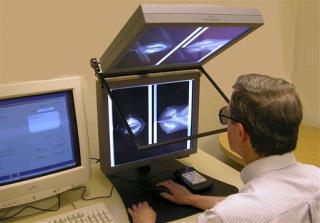 Mammograms Not Very Effective: Study
