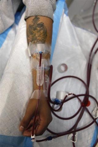 US Dialysis System a Costly Horror