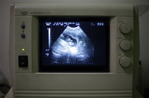 Fetuses to 'Testify' in Ohio Abortion Bill Debate