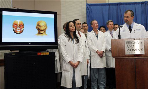 Boston Hospital Performs US' 1st Full Face Transplant