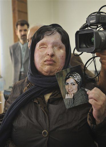 Ameneh Bahrami, Woman Blinded by Acid, Spares Attacker Majid Movahedi the Same Fate