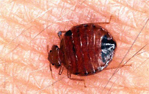 Body Hair Is Bedbug Warning System