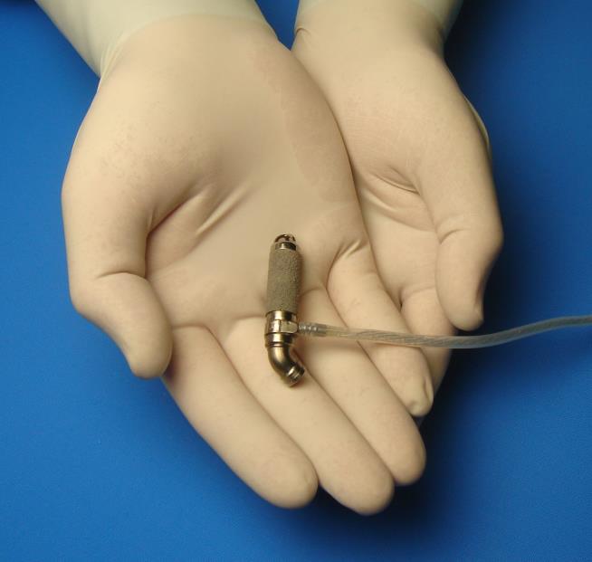 World's Smallest Artificial Heart Saves Baby's Life