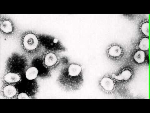 New SARS-Like Virus Can Spread Person-to-Person