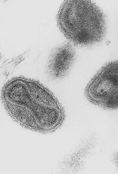 US Snaps Up Huge Stockpile of Smallpox Drug