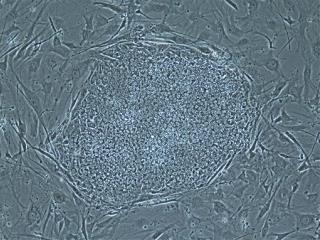 Human Stem Cells Made From Cloned Embryos