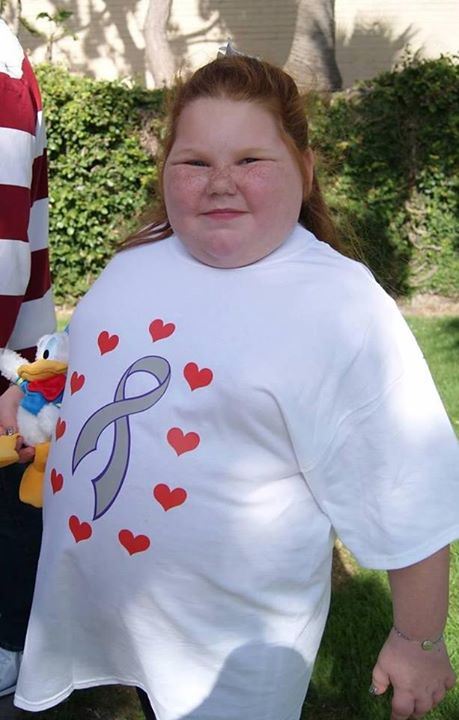 Girl Recovering After Obesity Surgery Changes
