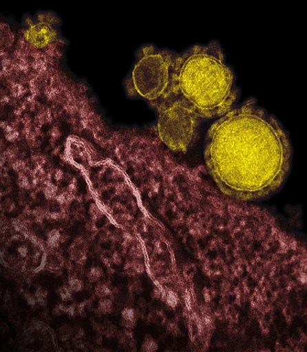 Confirmed: 2nd US Case of Mysterious MERS Virus